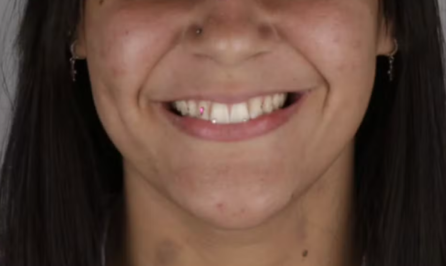 Jovem é presa suspeita de sair sem pagar por cristais nos dentes em Goiás